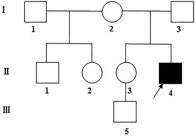 Mitochondrial 13513G>A Mutation With Low Mutant Load Presenting as Isolated Leber's Hereditary Optic Neuropathy Assessed by Next Generation Sequencing